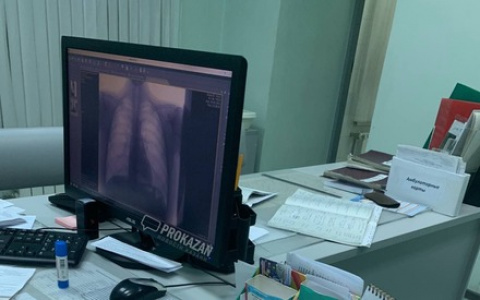 Женщине после поездки в автобусе пришлось обратиться в травмпункт