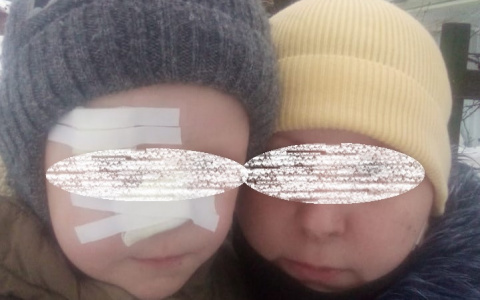 Ребенок распорол лицо до кости, упав на торчащие из снега штыри