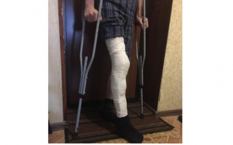 "Задержали и сломали ногу": владимирец обвиняет полицейских