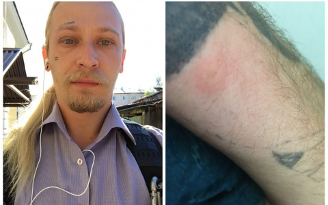 В Юрьев-Польском на людей нападают клещи