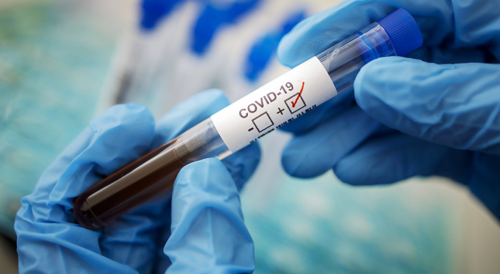 Во Владимирской области выявили еще 55 случаев заболевания коронавирусом