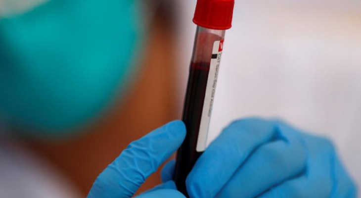 За сутки во Владимирской области выявили еще 44 случая коронавируса