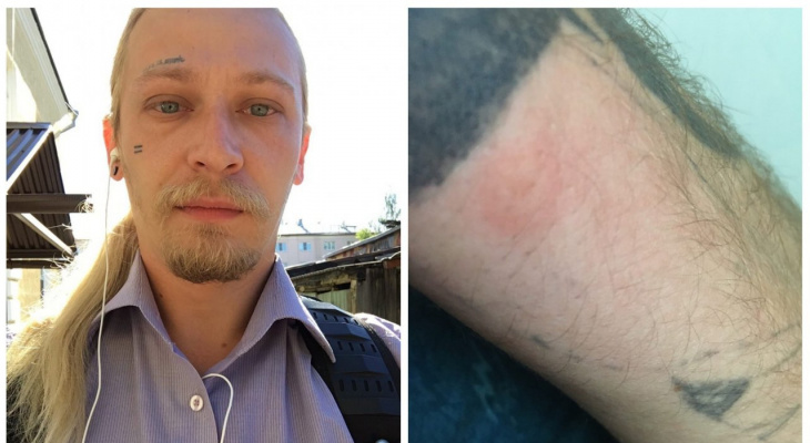 В Юрьев-Польском на людей нападают клещи В Юрьев-Польском на людей нападают клещи