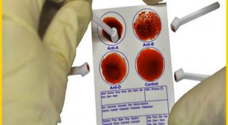 Тест крови в домашних условиях. Тест полоски на определение группы крови. Экспресс тест на резус-фактор. Экспресс тест на определение группы крови. Группа крови тест в аптеке.