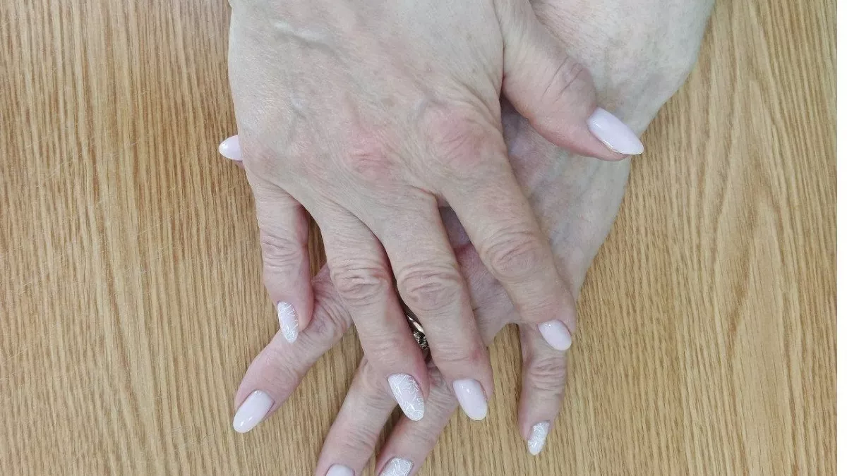 Сухая кожа рук весной: что делать, если крем не помогает — советы косметолога