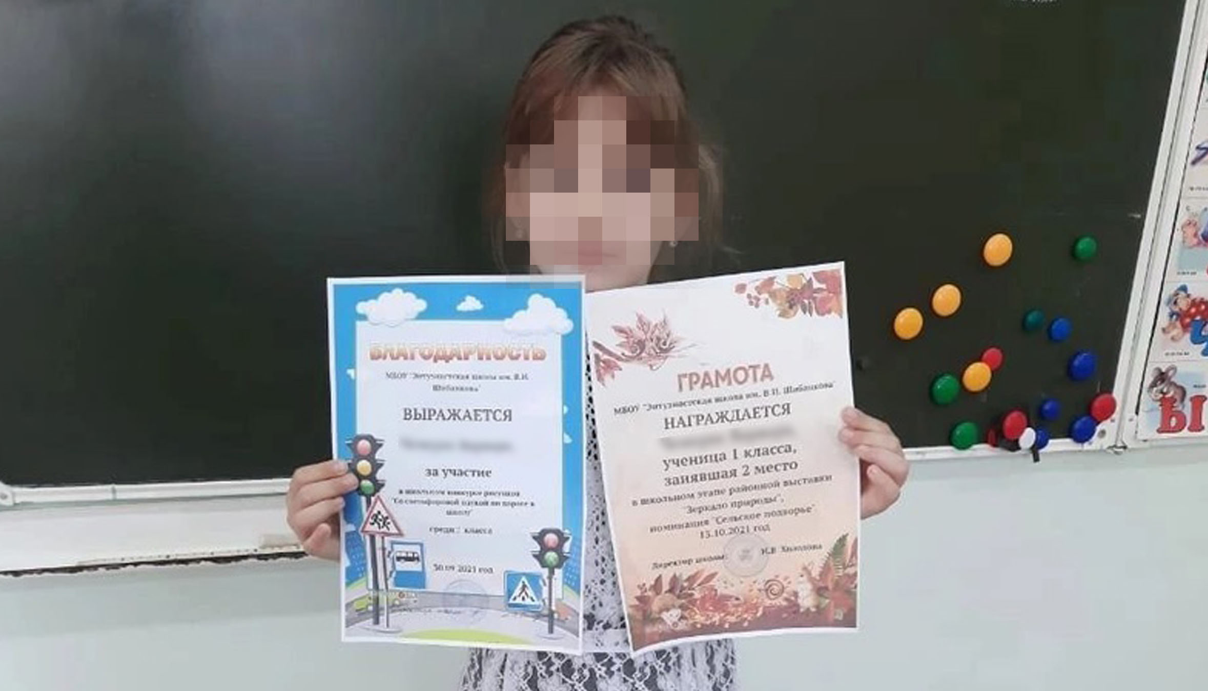  во Владимире школьница оказалась в реанимации с гнойной пневмонией