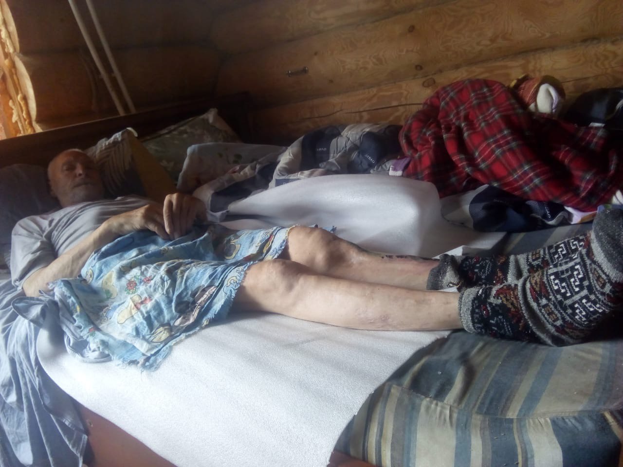 Во Владимире у лежачего инвалида отобрали инвалидность и не дают повторно