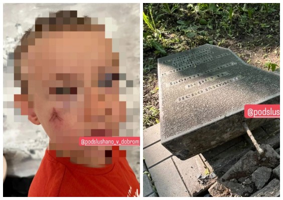 Во Владимире на 6-летнего мальчика рухнула плита памятника 