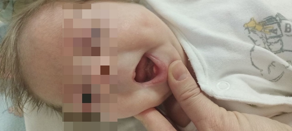 Во Владимире родился ребенок с первородными зубками