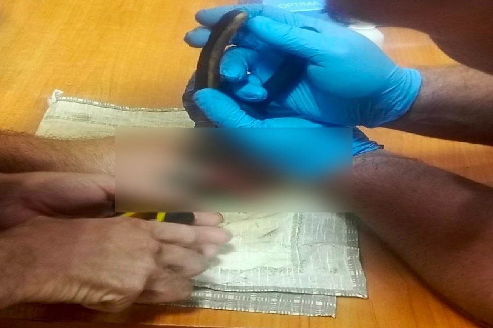Молодой спортсмен из Владимира едва не лишился пальца на тренировке
